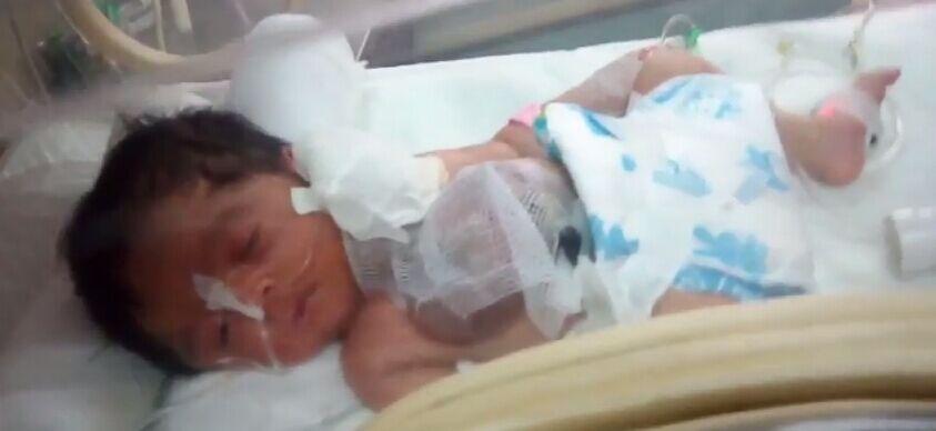 巴基斯坦可怜新生儿心脏裸露体外 年轻母亲吓坏